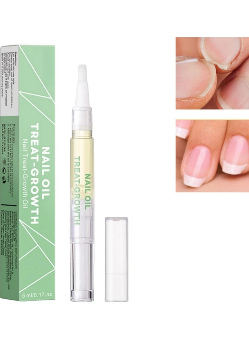 saykfoe Nail Care Solution, Nail Oil Treat Growth-Cuticle Oil Strengthens Nail Cuticles Removes Moisturizes and Nourishes, 5 ml - Image 1